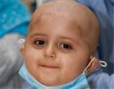 درمان قطعی 80 درصد کودکان مبتلا به سرطان خون در یزد/ دو سوم سرطان‌ها قابل پیشگیری است